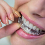 better alternative to Braces